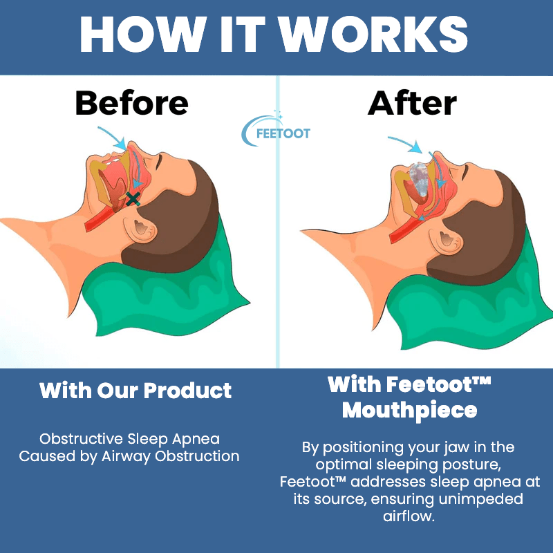 Glideo™ | MOUTHPIECE™