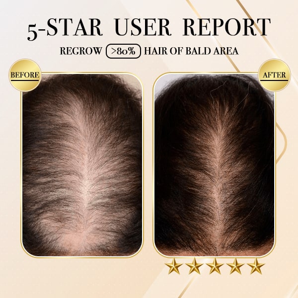 GingerGold HairCare Bar
