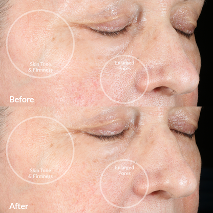 Glow & Cleanse Pro RQ