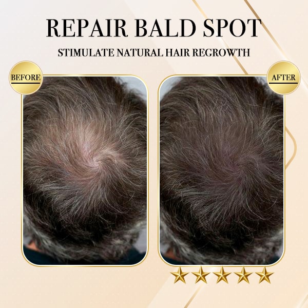 GingerGold HairCare Bar
