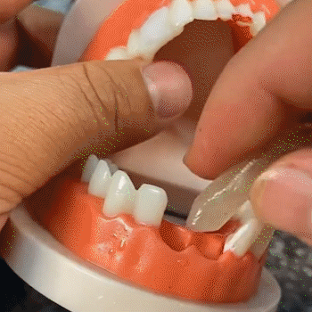 BUY 1, GET 1 FREE | SmileSaver Tooth Repair Duo
